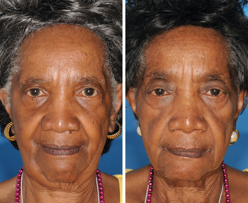 Illustration for article titled Guess which of these identical twins is the smoker